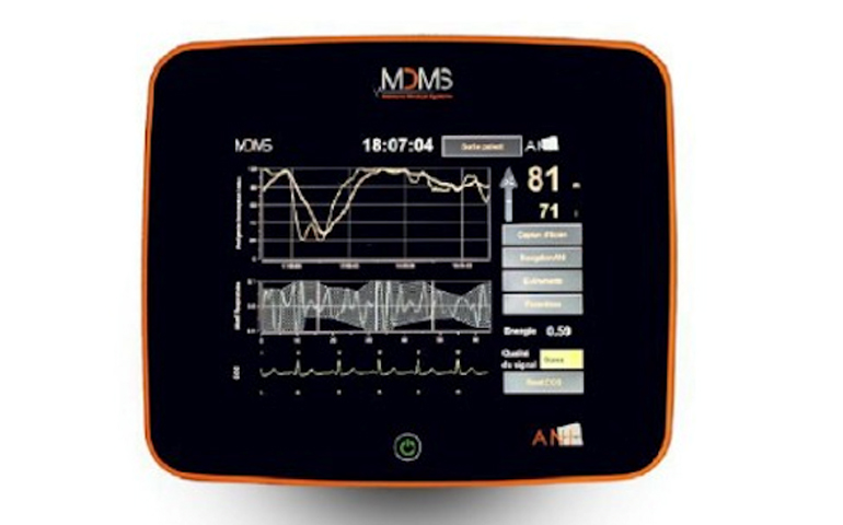 NIPE Monitor V1 NIPE Monitor V1